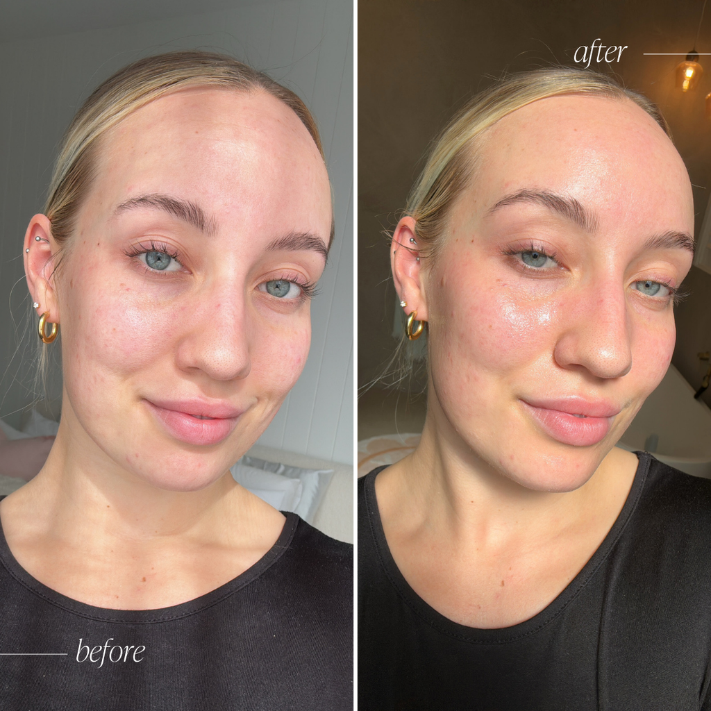 Hydraboost C Sheet Mask