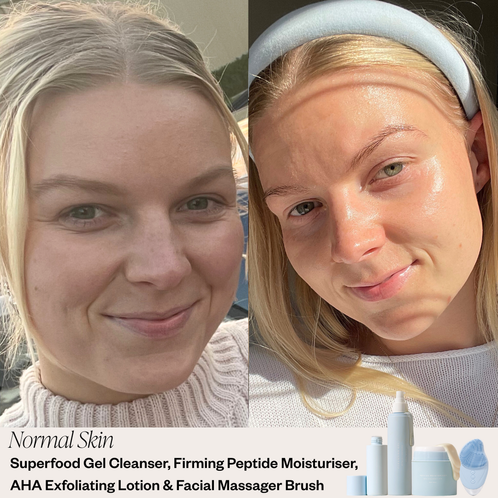 Beginner Skincare System - Sensitive