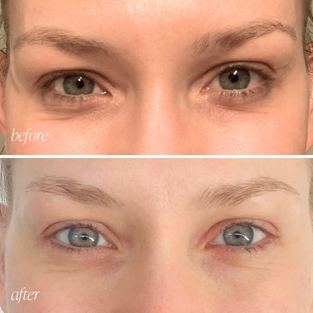 Firming Peptide Eye Cream