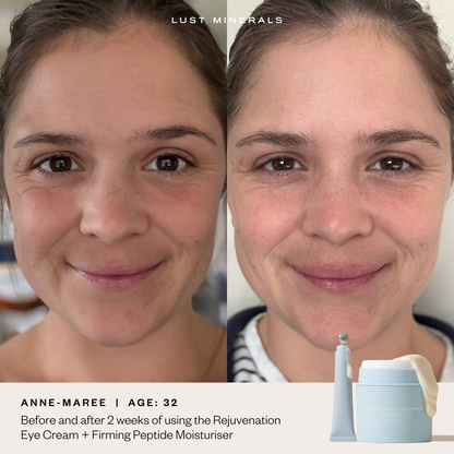 Before and after eye cream results showing reduced puffiness and brighter under-eyes in 28 days
