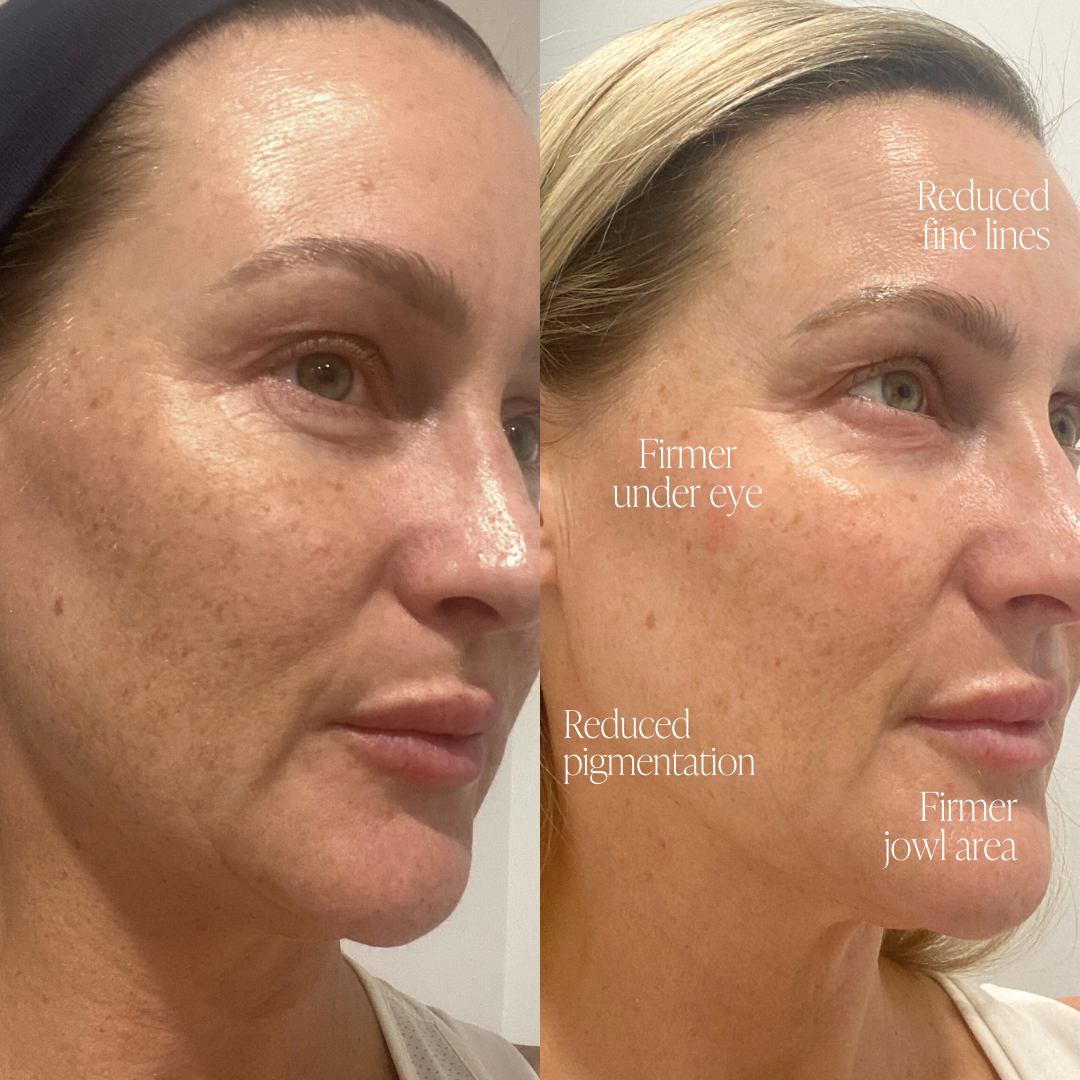 Firming Peptide Moisturiser - Trial Size