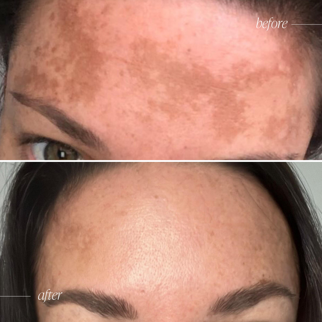 Vitamin C Brightening Serum - Trial Size