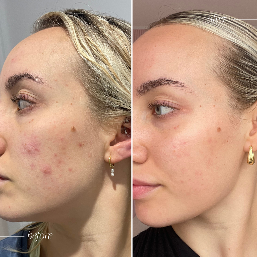 Original Formula - Probiotic Moisturiser +