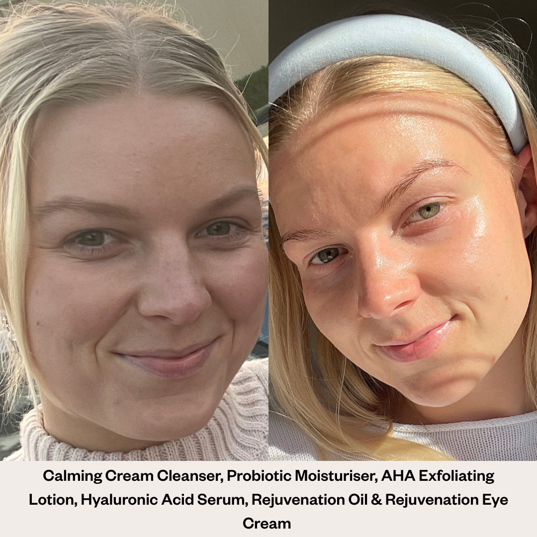 Rejuvenation Oil - Original Formula