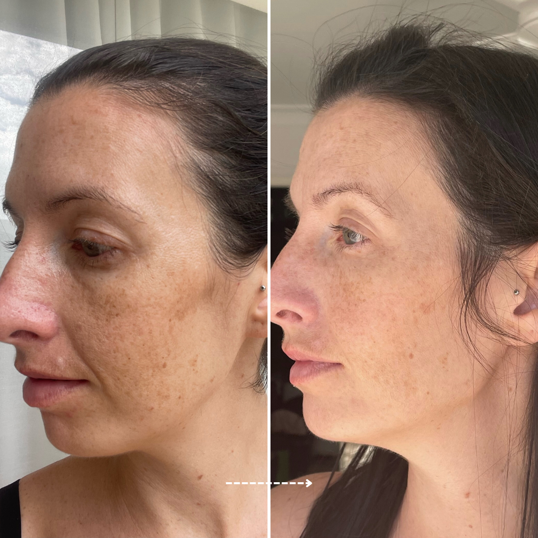 Firming Peptide Moisturiser - Trial Size
