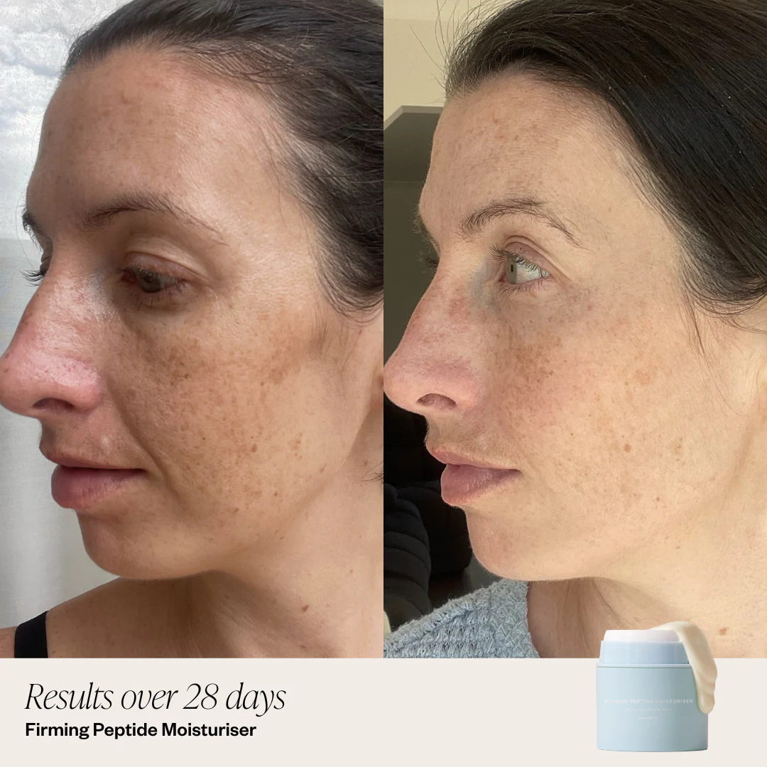 4 Step Brightening System