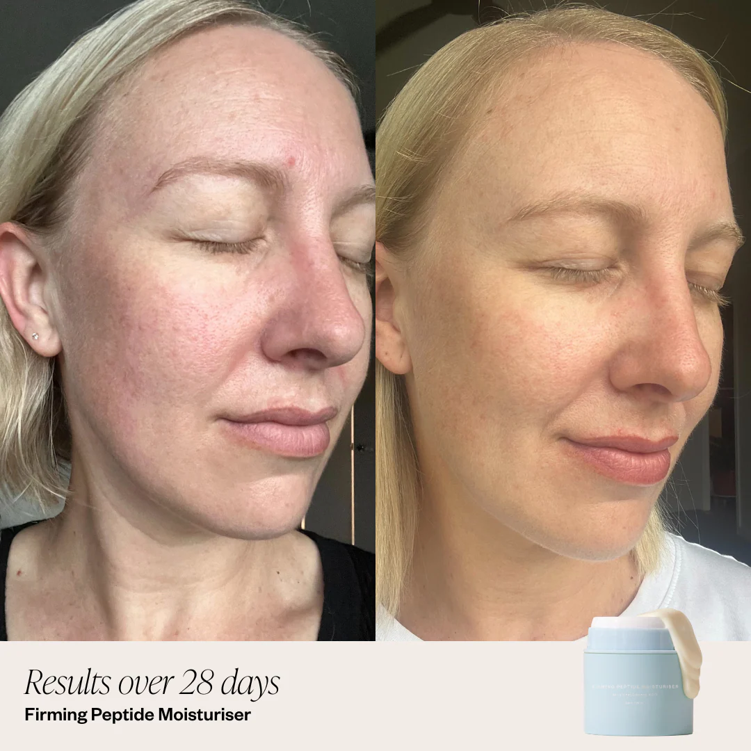 4 Step Brightening System
