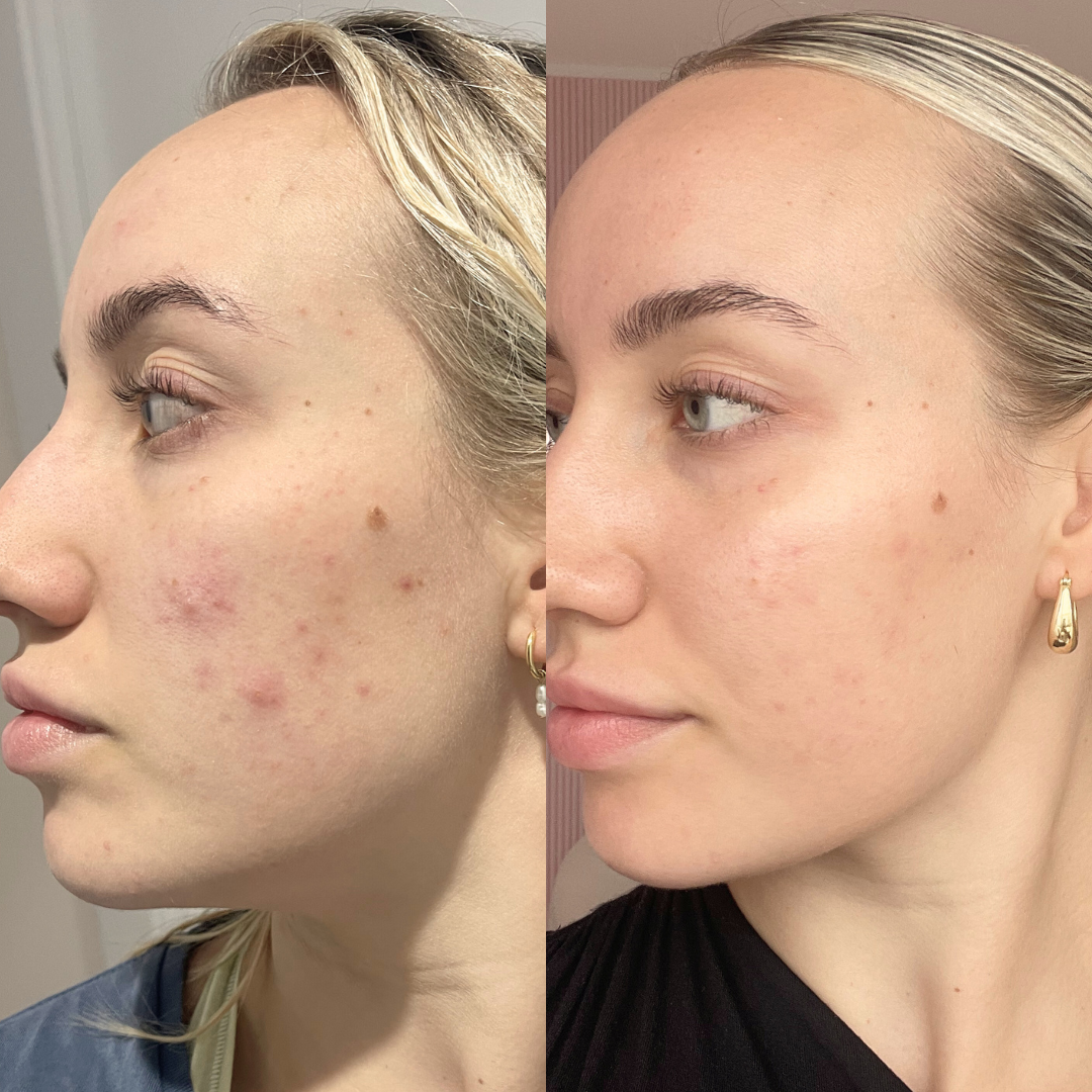 Skincare Try it all Bundle - Trial Size