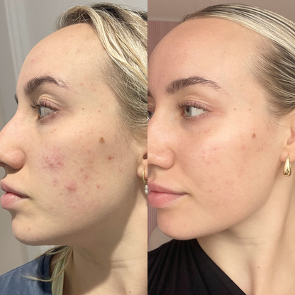 Skincare Try it all Bundle - Trial Size