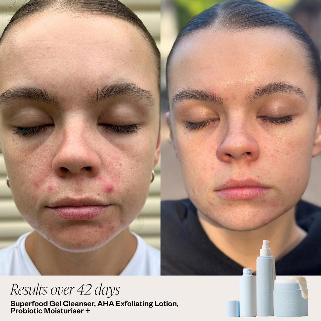Probiotic Moisturiser +