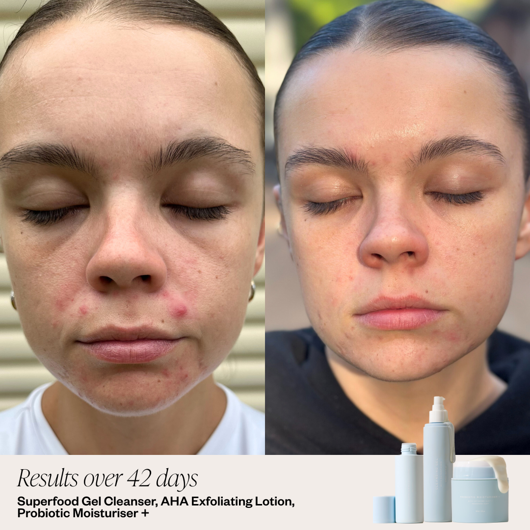 Probiotic Moisturiser +