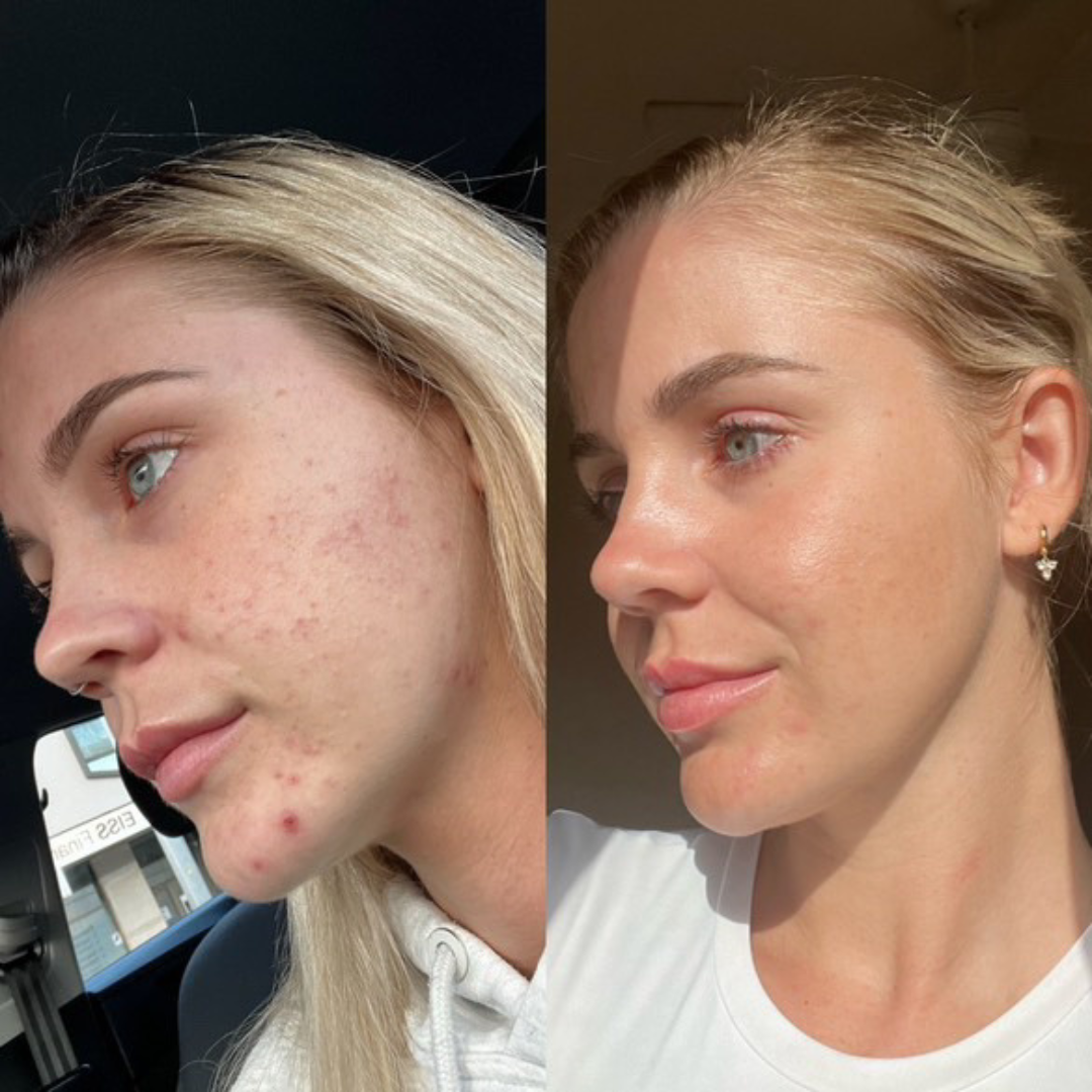 Balancing Duo + SPF