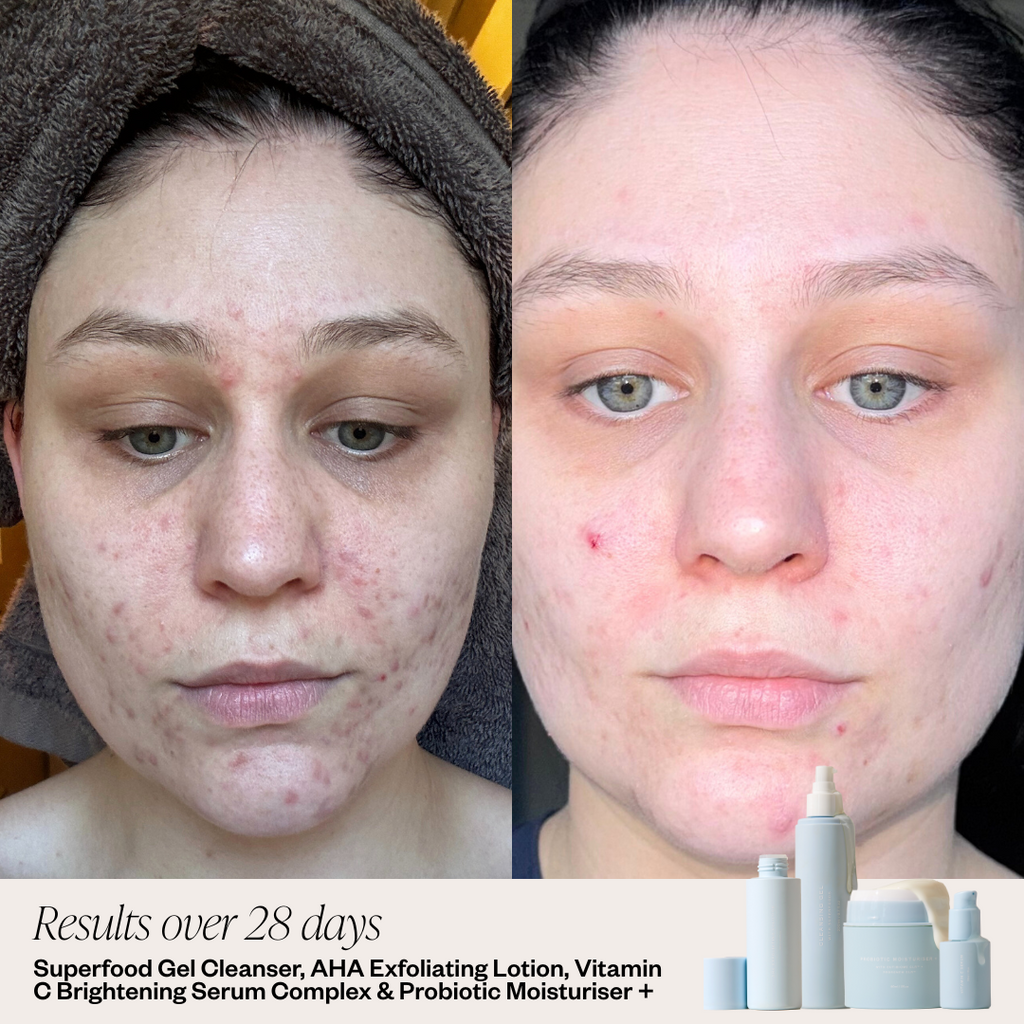 Probiotic Moisturiser +