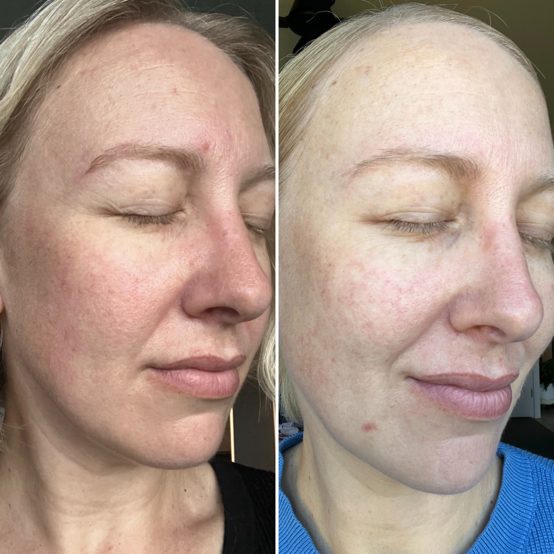 Firming Peptide Moisturiser - Trial Size