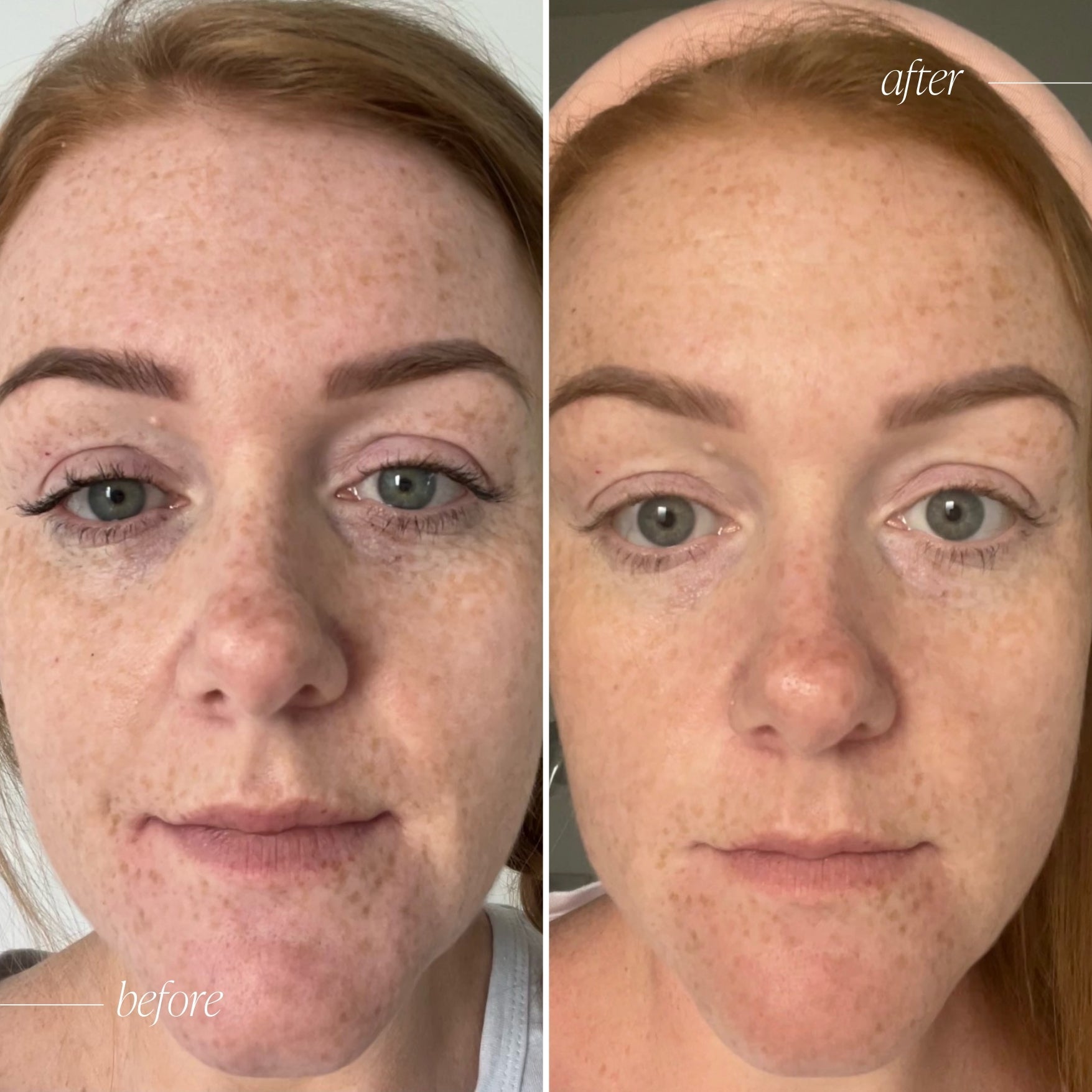 Vitamin C Brightening Serum - Trial Size