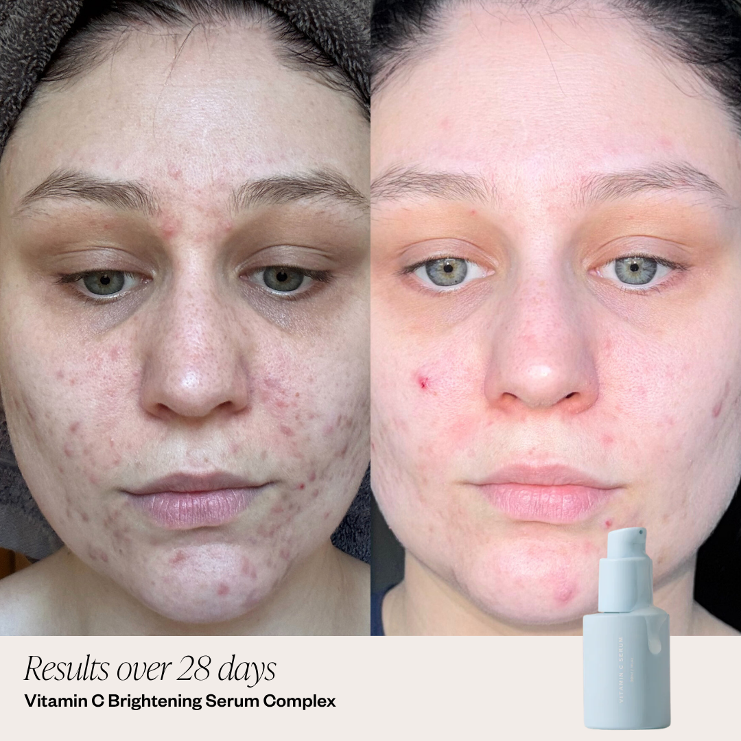 3 Step Clearing Serum System