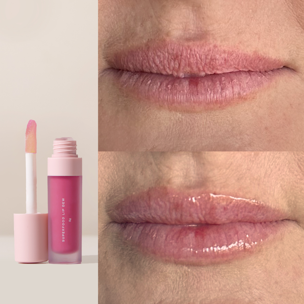 Superfood Lip Dew + Plump Shot