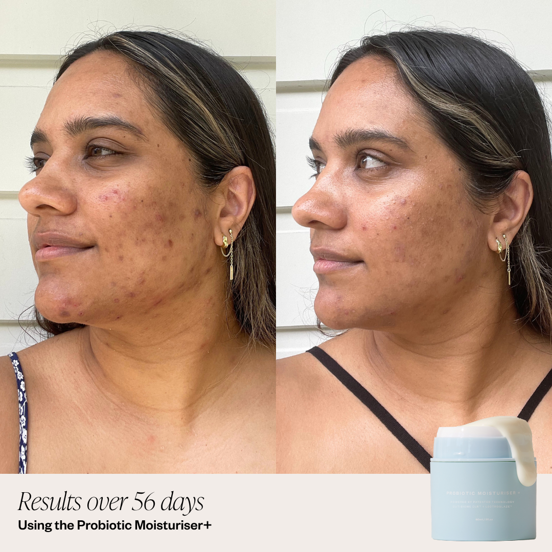Clearing Duo + SPF
