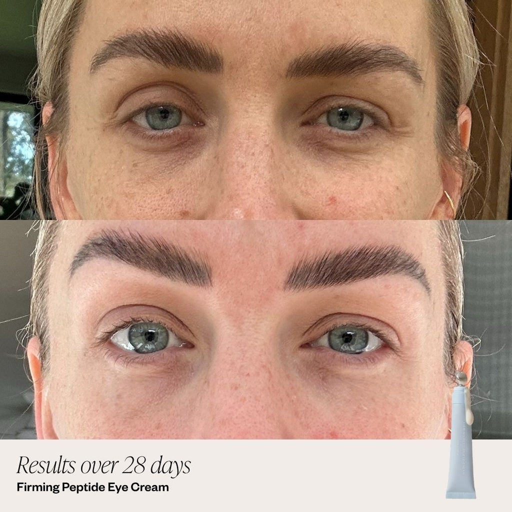 4 Step Brightening System