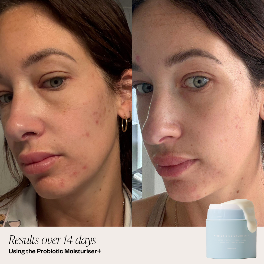 Probiotic Moisturiser +