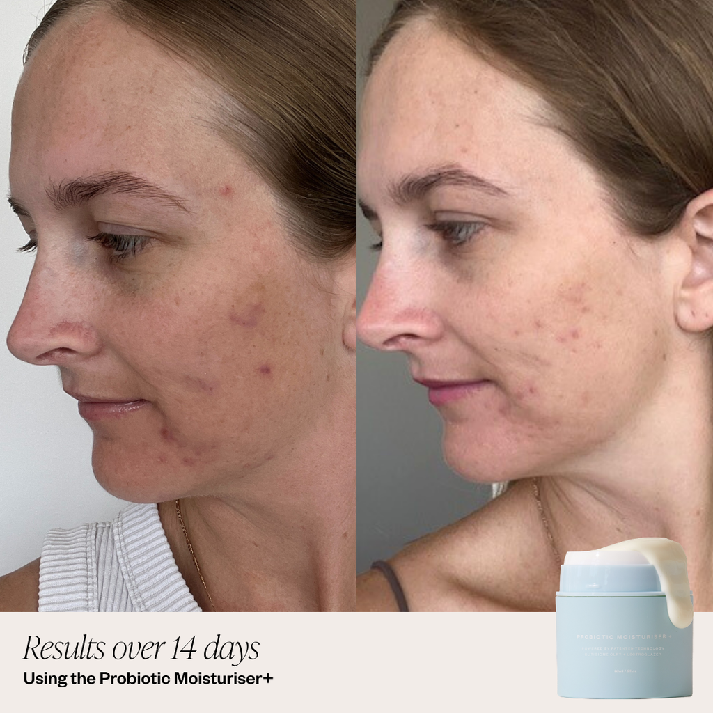 Probiotic Moisturiser +